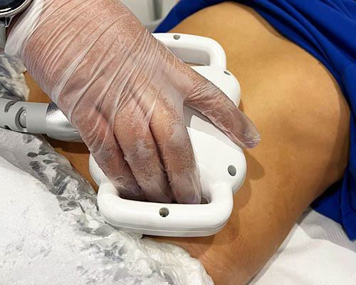 Cavitation Featured